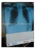 Hot sale silm X-ray film viewer