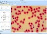 Microscopic Analysis Software ScopeImage-9.0