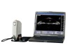 Ultrasound Biomicroscopy