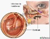 medical ear specula
